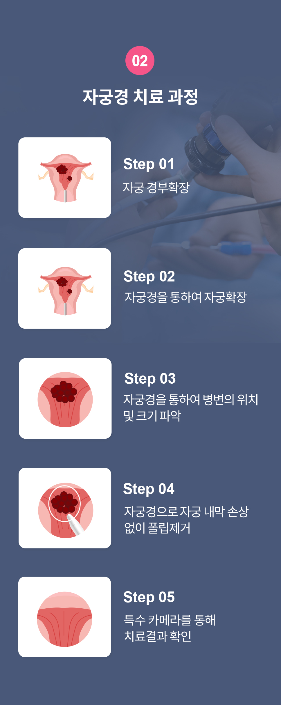 복강경센터 자궁내시경 치료 과정